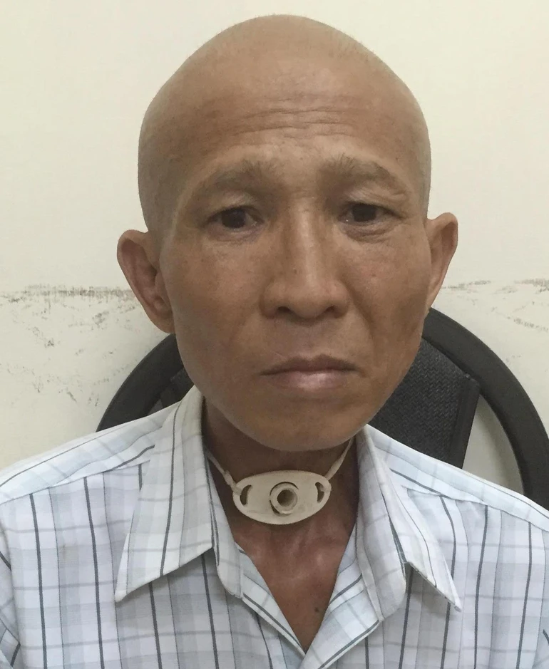 Giúp ông Sỹ điều trị ung thư thanh quản